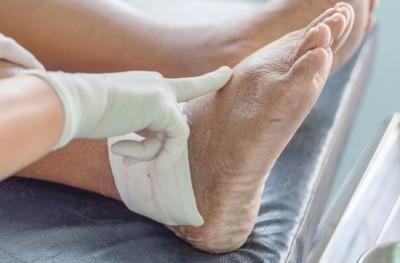 Ce înseamnă un nivel de acid uric ridicat. Alimente pe care nu trebuie să le consumi