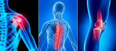 Cum să combați durerile articulare. Remediile naturiste ce-ți ”iau” durerile cu mâna