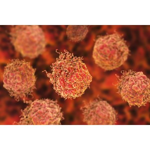 Cat traiesti cu cancer de prostata