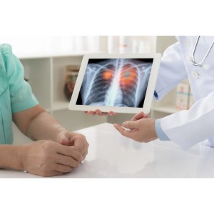 Cat traiesti cu cancer pulmonar