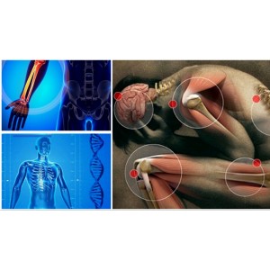 Ce este cancerul osos și cum se manifestă. Care sunt tumorile întâlnite în rândul copiilor