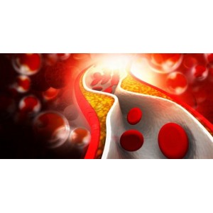 Cele mai eficiente remedii naturiste pentru a ține sub control tensiunea și colesterolul