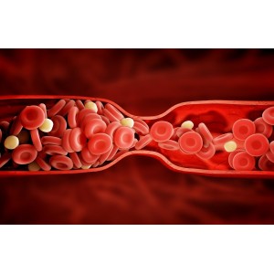 Cele mai eficiente remedii naturiste pentru prevenirea formării cheagurilor de sânge