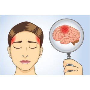 Cum poți să previi un accident vascular cerebral. Sfaturi de care să ții cont