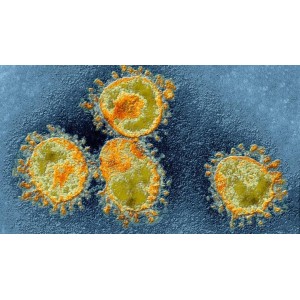 Cum știi că ai fost infectată cu noul coronavirus. Simptomele pe care nu trebuie să le ignori