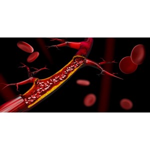  Curățarea vaselor de sânge