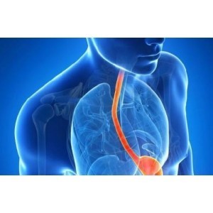 Reflux gastroesofagian, arsuri la stomac