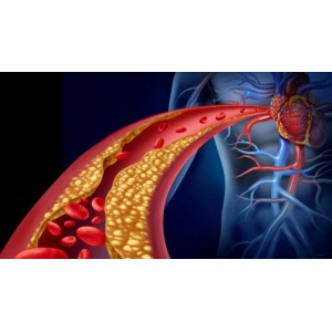  Remedii naturiste eficiente pentru reducerea colesterolului din sânge