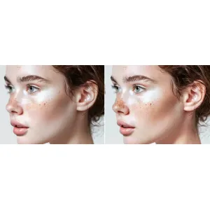 Vitamina B3 Și Importanța Ei Pentru Organism